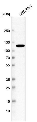 MSH2 Antibody in Western Blot (WB)