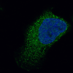 Cardiac Troponin T Monoclonal Antibody (CL13403)
