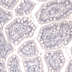 Cardiac Troponin T Antibody in Immunohistochemistry (Paraffin) (IHC (P))