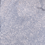 Cardiac Troponin T Antibody in Immunohistochemistry (Paraffin) (IHC (P))