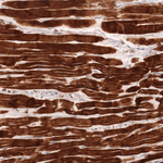 Cardiac Troponin T Antibody in Immunohistochemistry (Paraffin) (IHC (P))