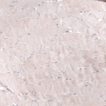 Cardiac Troponin T Antibody in Immunohistochemistry (Paraffin) (IHC (P))