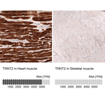 Cardiac Troponin T Antibody in Immunohistochemistry (Paraffin) (IHC (P))