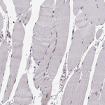 SNAIL Antibody in Immunohistochemistry (Paraffin) (IHC (P))