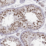 SNAIL Antibody in Immunohistochemistry (Paraffin) (IHC (P))