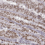 SNAIL Antibody in Immunohistochemistry (Paraffin) (IHC (P))