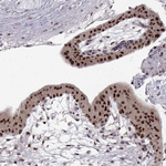 SNAIL Antibody in Immunohistochemistry (Paraffin) (IHC (P))