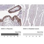 SNAIL Antibody in Immunohistochemistry (Paraffin) (IHC (P))