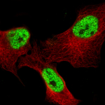 BCL6 Monoclonal Antibody (CL14612)