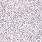 BCL6 Antibody in Immunohistochemistry (Paraffin) (IHC (P))