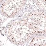 BCL6 Antibody in Immunohistochemistry (Paraffin) (IHC (P))