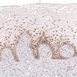 BCL6 Antibody in Immunohistochemistry (Paraffin) (IHC (P))