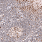 BCL6 Antibody in Immunohistochemistry (Paraffin) (IHC (P))