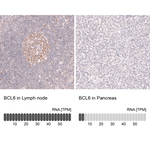 BCL6 Antibody in Immunohistochemistry (Paraffin) (IHC (P))
