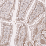 BCL6 Antibody in Immunohistochemistry (Paraffin) (IHC (P))