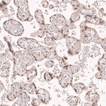 BCL6 Antibody in Immunohistochemistry (Paraffin) (IHC (P))