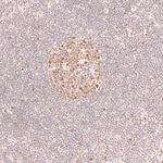 BCL6 Antibody in Immunohistochemistry (Paraffin) (IHC (P))