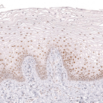 BCL6 Antibody in Immunohistochemistry (Paraffin) (IHC (P))
