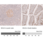 BCL6 Antibody in Immunohistochemistry (Paraffin) (IHC (P))