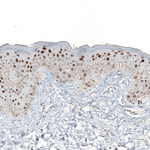 GATA3 Antibody in Immunohistochemistry (Paraffin) (IHC (P))