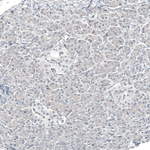 GATA3 Antibody in Immunohistochemistry (Paraffin) (IHC (P))