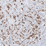 GATA3 Antibody in Immunohistochemistry (Paraffin) (IHC (P))