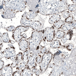 GATA3 Antibody in Immunohistochemistry (Paraffin) (IHC (P))