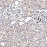 GATA3 Antibody in Immunohistochemistry (Paraffin) (IHC (P))
