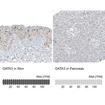 GATA3 Antibody in Immunohistochemistry (Paraffin) (IHC (P))