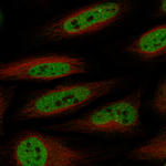 BRG1 Antibody in Immunocytochemistry (ICC/IF)