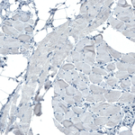 Occludin Antibody in Immunohistochemistry (Paraffin) (IHC (P))