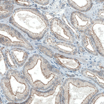 Occludin Antibody in Immunohistochemistry (Paraffin) (IHC (P))