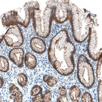 Occludin Antibody in Immunohistochemistry (Paraffin) (IHC (P))