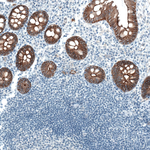 Occludin Antibody in Immunohistochemistry (Paraffin) (IHC (P))