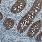 Occludin Antibody in Immunohistochemistry (Paraffin) (IHC (P))