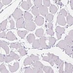 Occludin Antibody in Immunohistochemistry (Paraffin) (IHC (P))