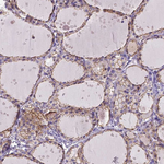 Occludin Antibody in Immunohistochemistry (Paraffin) (IHC (P))