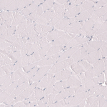 Myeloperoxidase Antibody in Immunohistochemistry (Paraffin) (IHC (P))