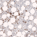 Myeloperoxidase Antibody in Immunohistochemistry (Paraffin) (IHC (P))
