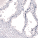 Myeloperoxidase Antibody in Immunohistochemistry (Paraffin) (IHC (P))