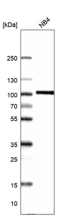 Myeloperoxidase Antibody in Western Blot (WB)