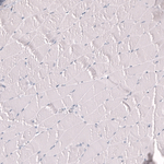 Myeloperoxidase Antibody in Immunohistochemistry (Paraffin) (IHC (P))