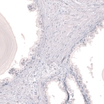 Myeloperoxidase Antibody in Immunohistochemistry (Paraffin) (IHC (P))