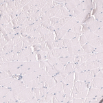 Myeloperoxidase Antibody in Immunohistochemistry (Paraffin) (IHC (P))