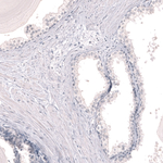 Myeloperoxidase Antibody in Immunohistochemistry (Paraffin) (IHC (P))