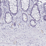 PODXL Antibody in Immunohistochemistry (Paraffin) (IHC (P))