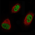 EZH2 Monoclonal Antibody (CL11915)