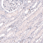EZH2 Antibody in Immunohistochemistry (Paraffin) (IHC (P))