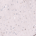 EZH2 Antibody in Immunohistochemistry (Paraffin) (IHC (P))