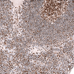 EZH2 Antibody in Immunohistochemistry (Paraffin) (IHC (P))
